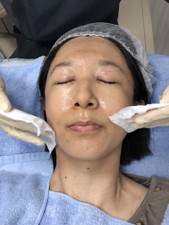高階抗老 陳裕豪醫師 | 雞尾酒技術除斑抗老