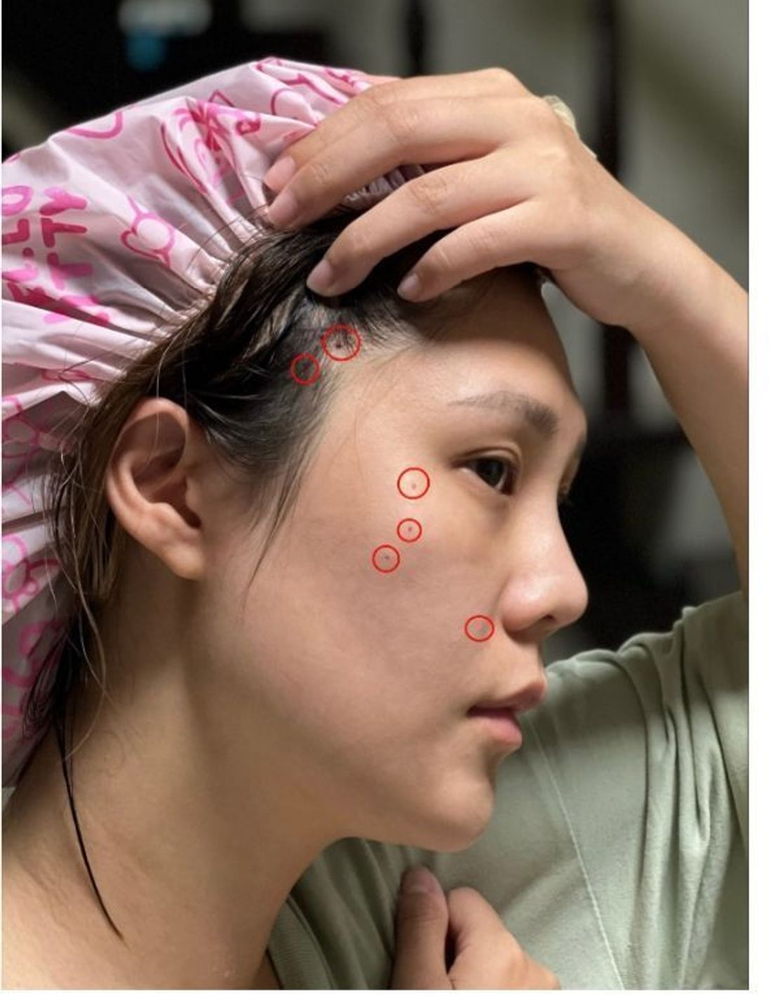 高階抗老 陳裕豪醫師 | 高階止痛技術 微創筋膜重建抗老拉提