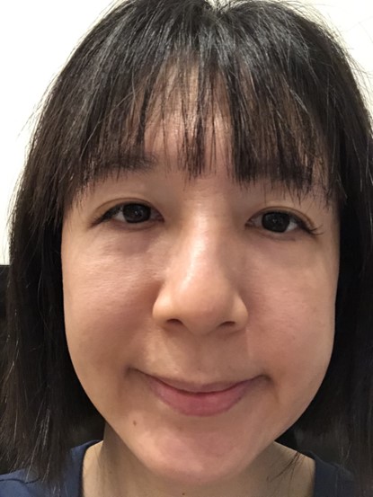 高階抗老 陳裕豪醫師 | 雞尾酒技術除斑抗老