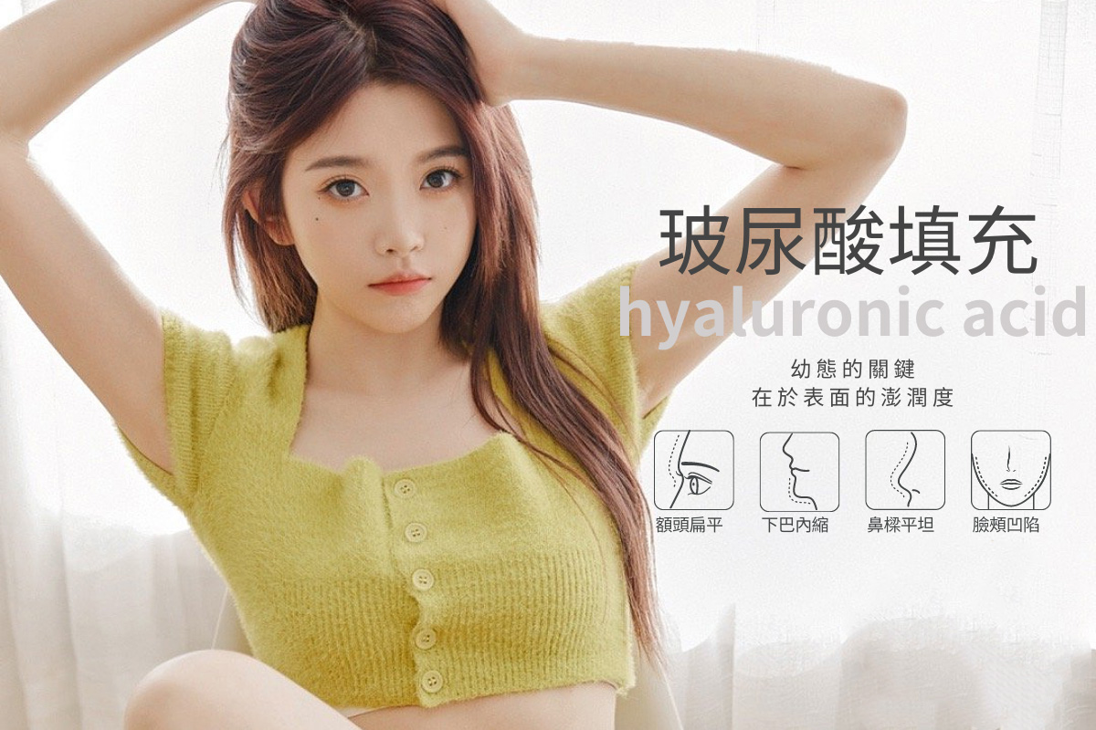醫美診所推薦｜玻尿酸｜瑞提醫美診所