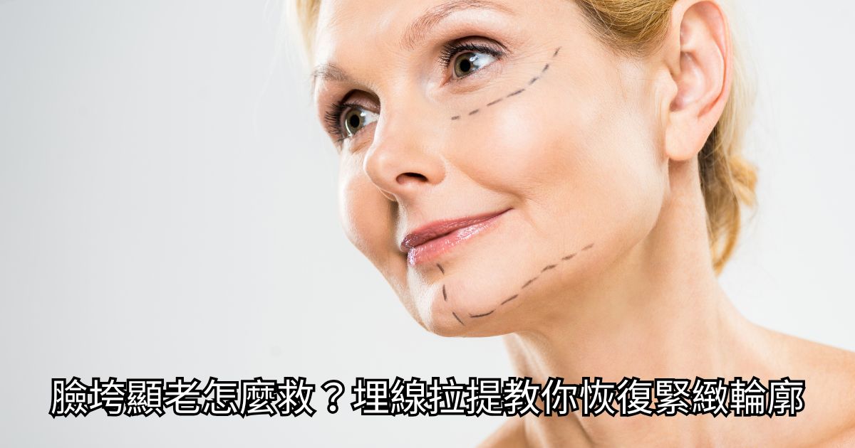 高階抗老 陳裕豪醫師 | 雞尾酒技術除斑抗老